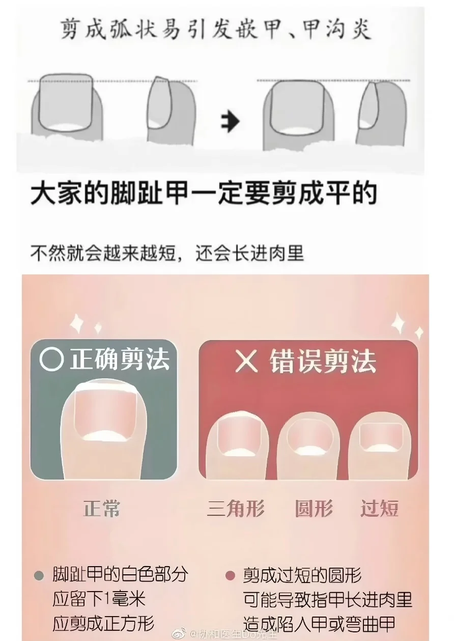 跟风央妈剪甲(很简单)