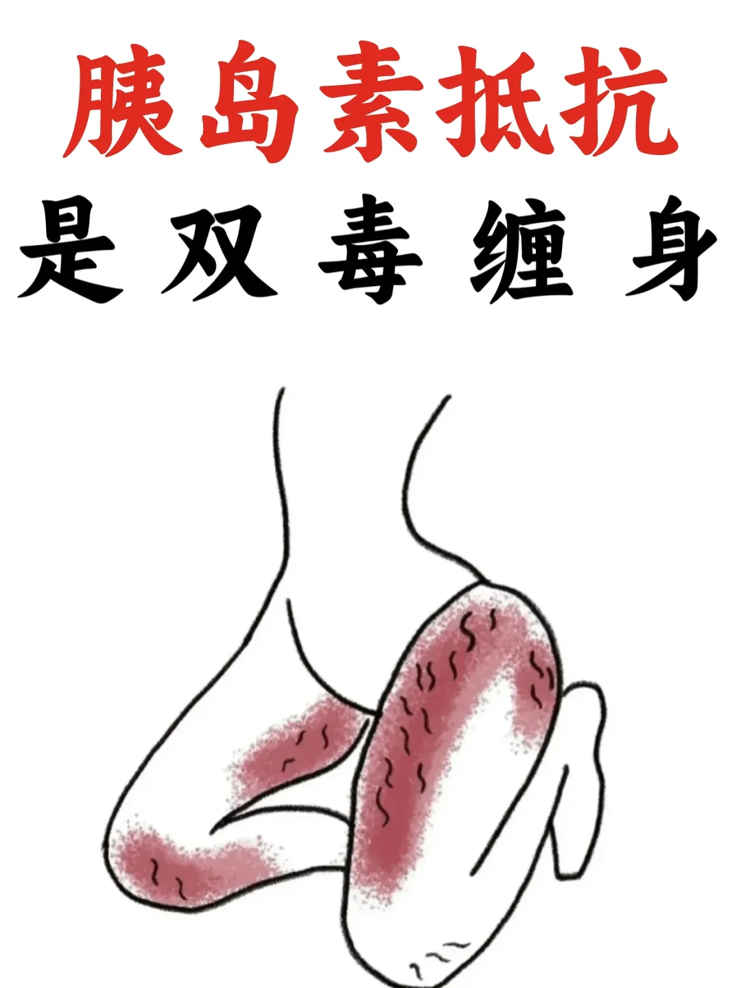 真相是：胰岛素抵抗根本不是营养过剩