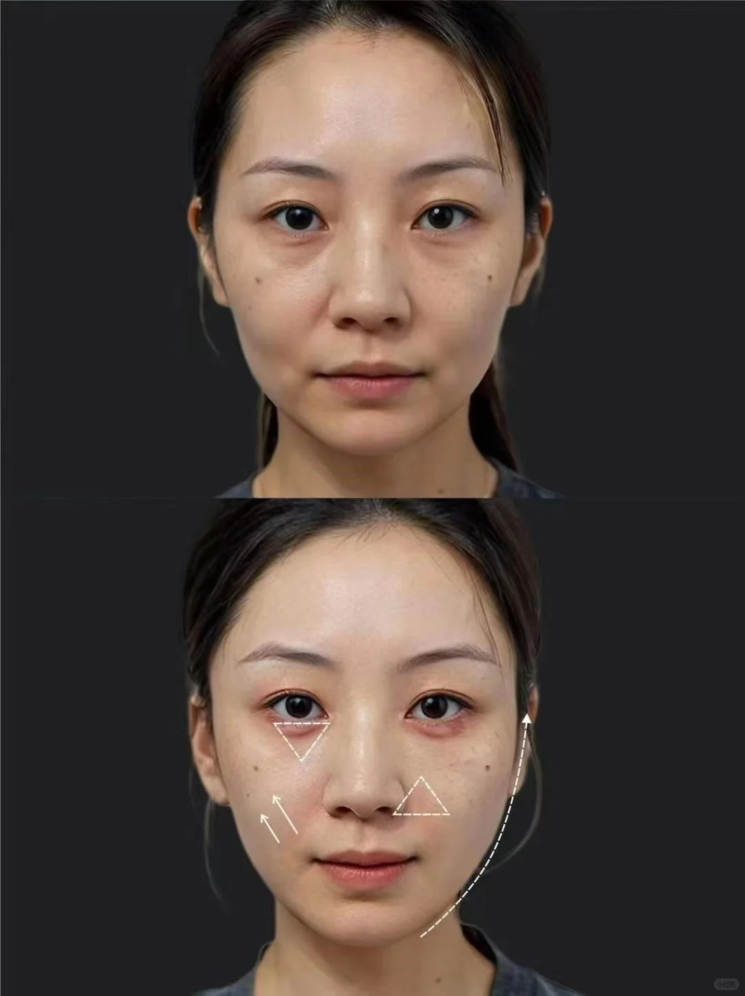 ??‍♀️【幼态脸·打造青春颜】 幼态脸不是简
