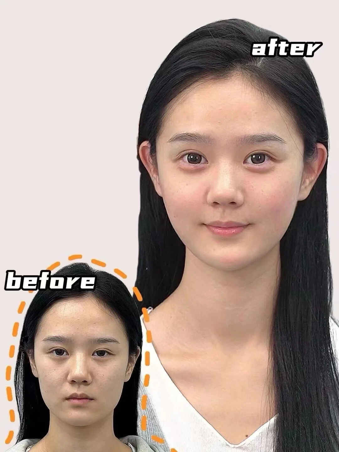 ??‍♀️【幼态脸·打造青春颜】 幼态脸不是简