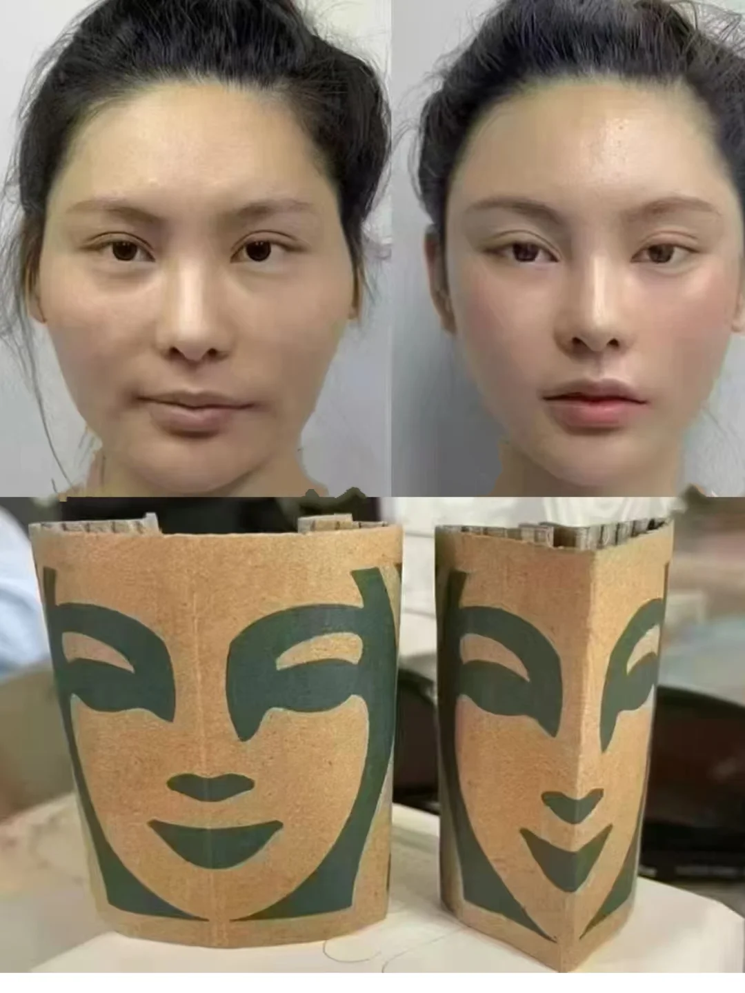 论脸部折叠度的重要性:骨骼抗衰的神奇。