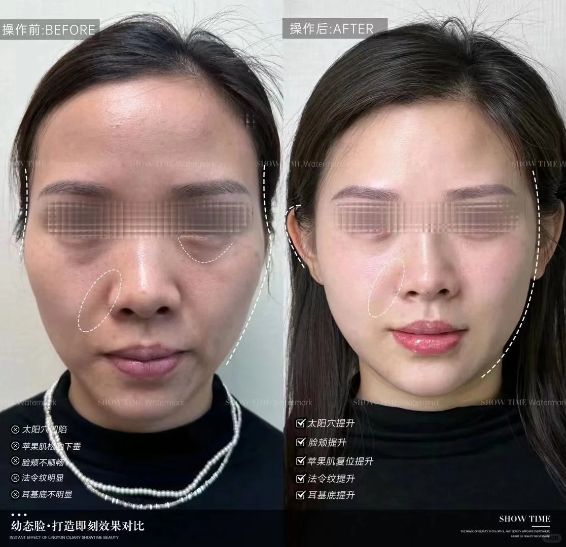 ??‍♀️【幼态脸·打造青春颜】 幼态脸不是简