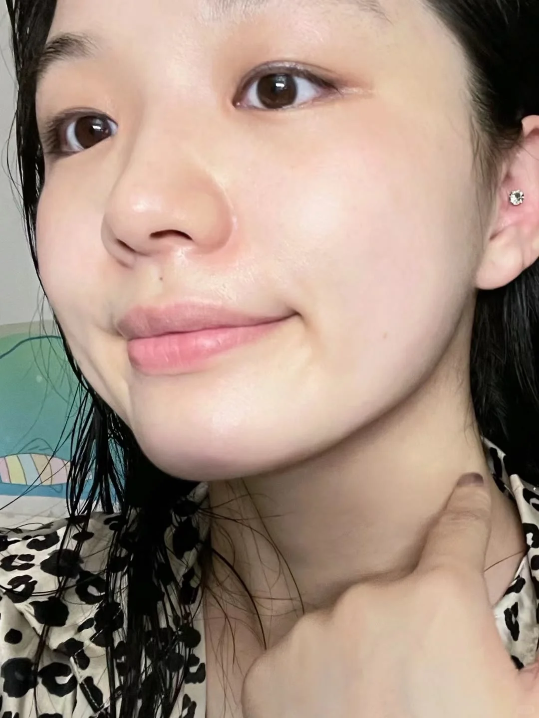 你这辈子有没有为“烂脸”拼过命？