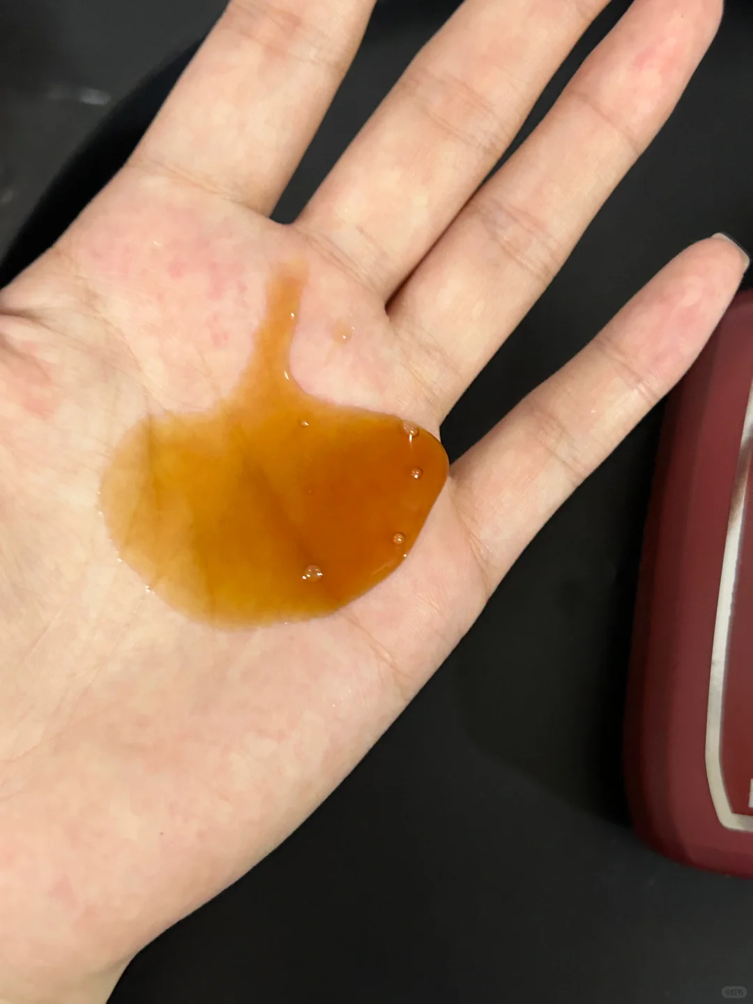 脱发的烦恼谁能懂？