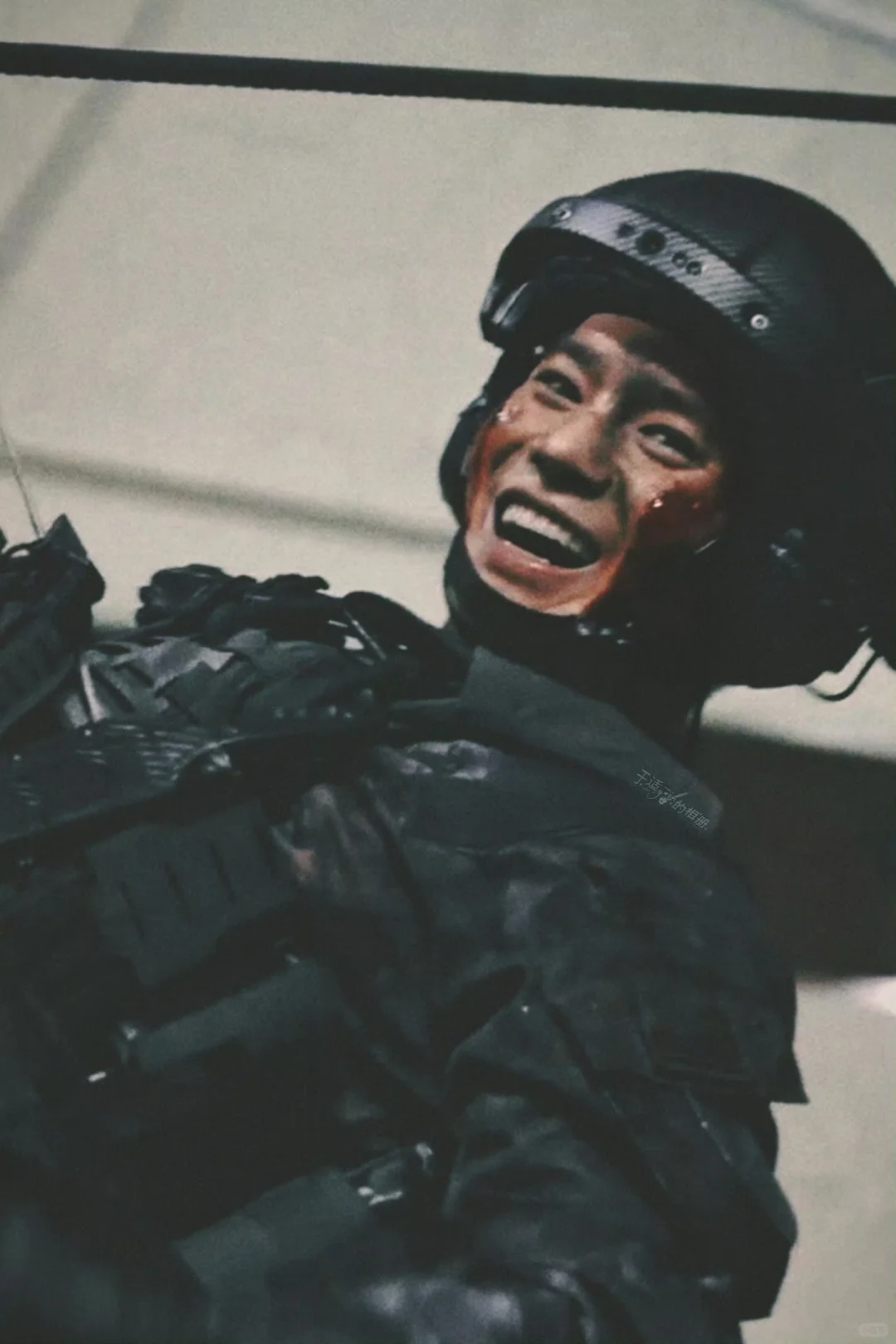 受了些小伤 不碍事儿