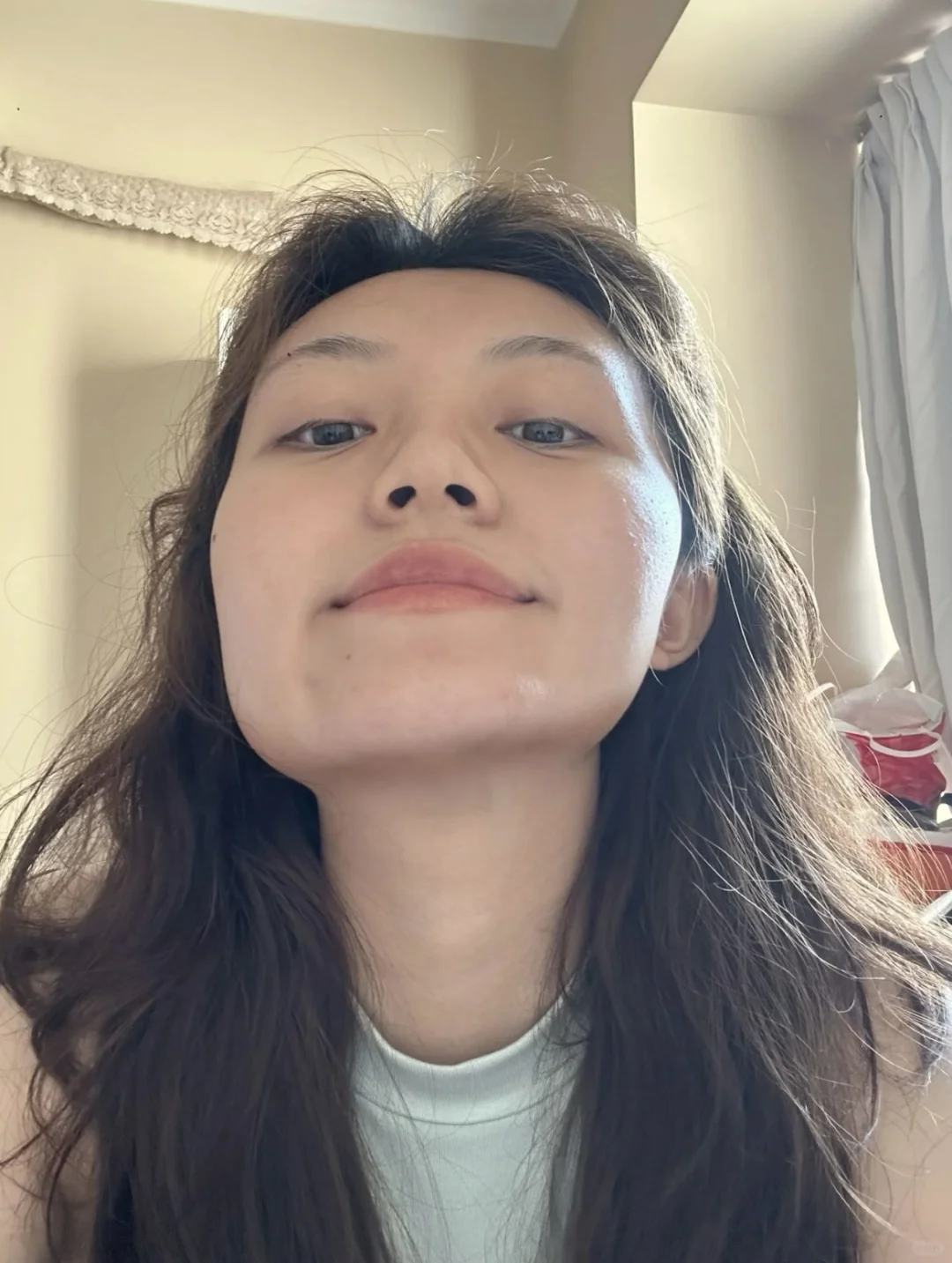 深圳颞下颌关节紊乱针了6次，美我一大跳！