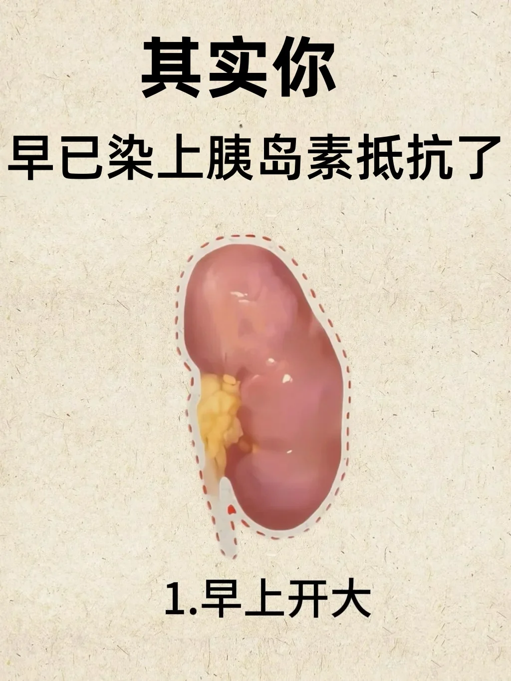⚠注意出现这些其实已经染上胰岛素抵抗了