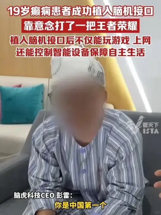 中国首位脑机接口患者靠意念打游戏