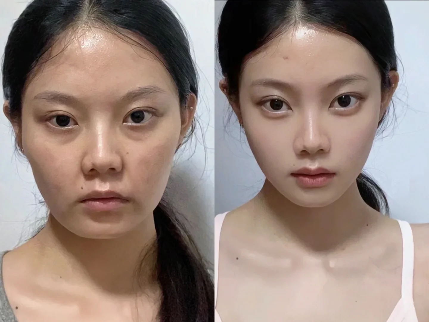 原来我的骨相美只是迟到了