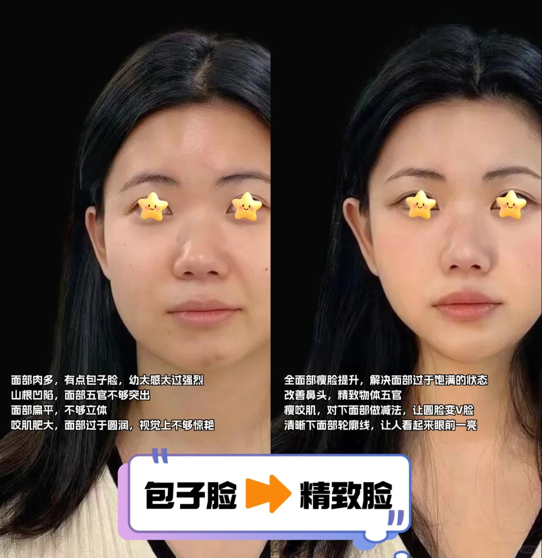 全脸打造+轮廓+提升 赢麻了有没有