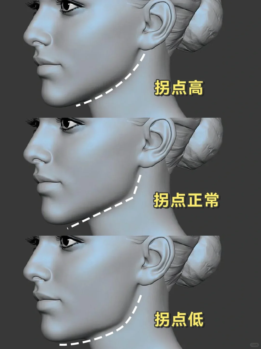 下颌线拐点的高低，才是决定v脸的关键