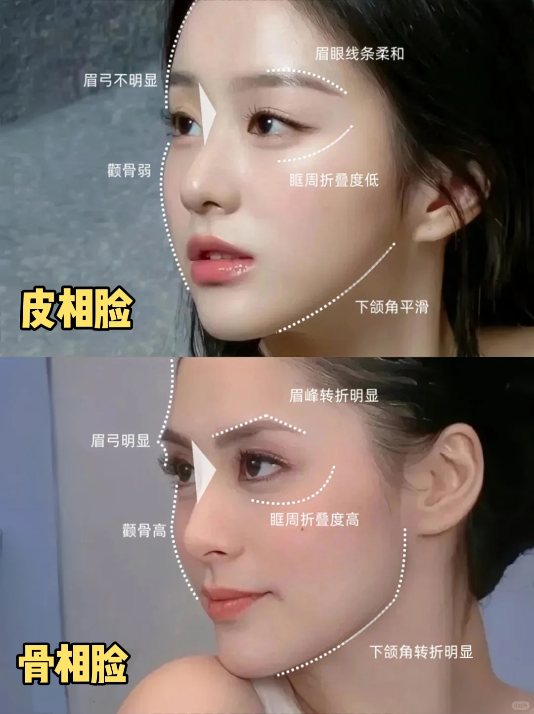 骨相美VS皮相美｜原来区别这么大！！