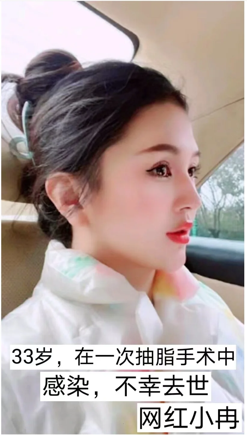 五位疯狂整容的女网红