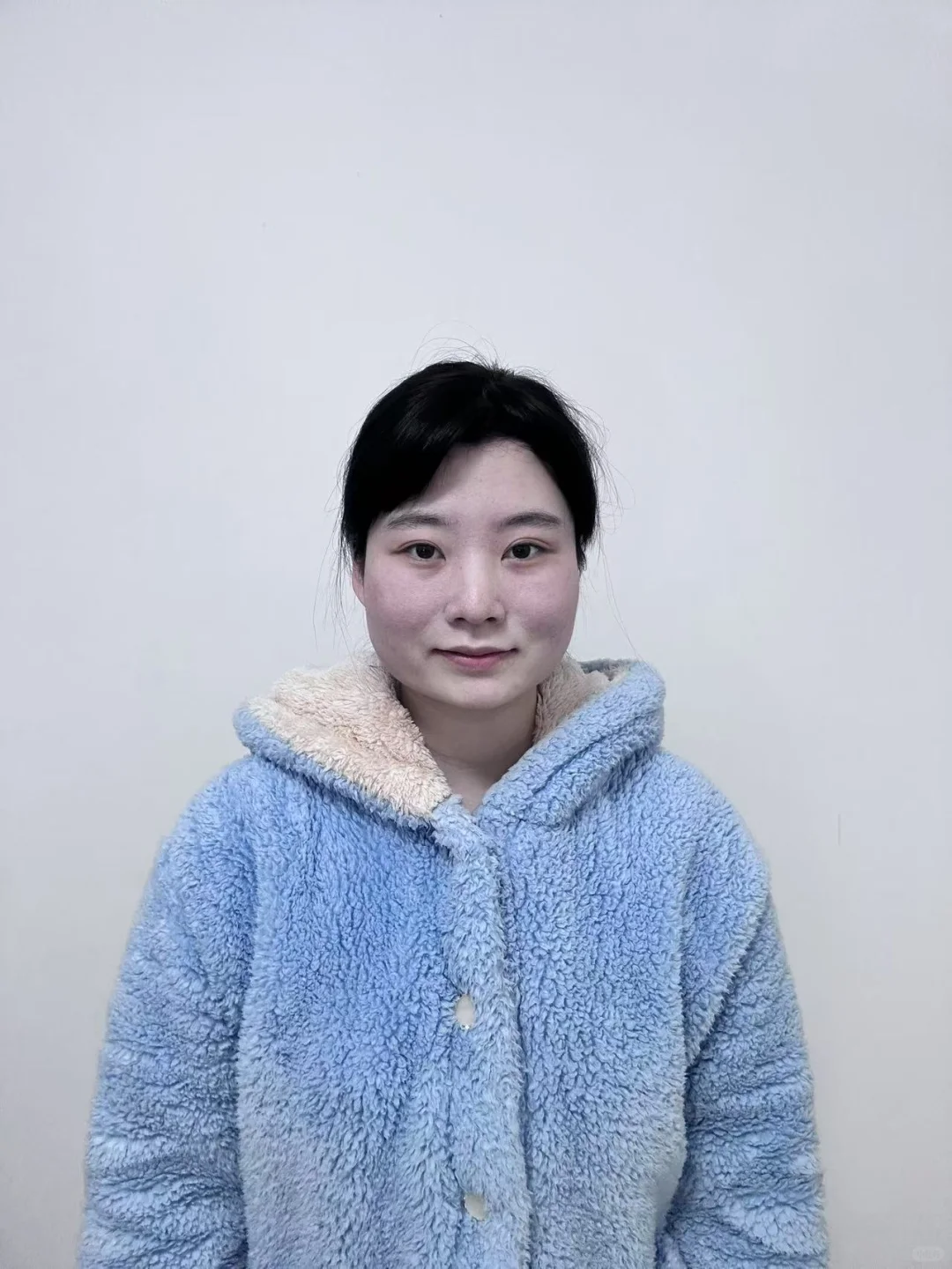 左滑看瘦脸针一个多月的效果