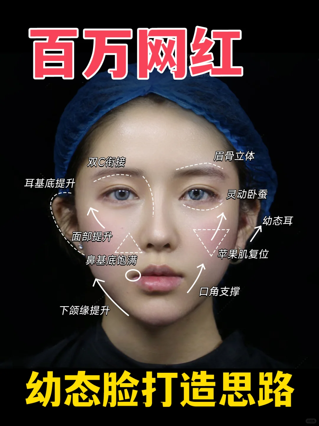随时被下架，百万网红幼态脸打造思路