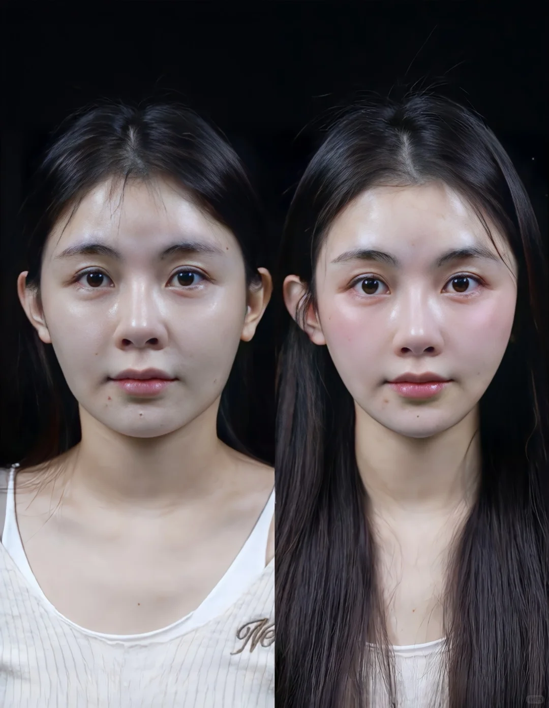 美业朋友圈素材|美业高清案例|幼态脸打造