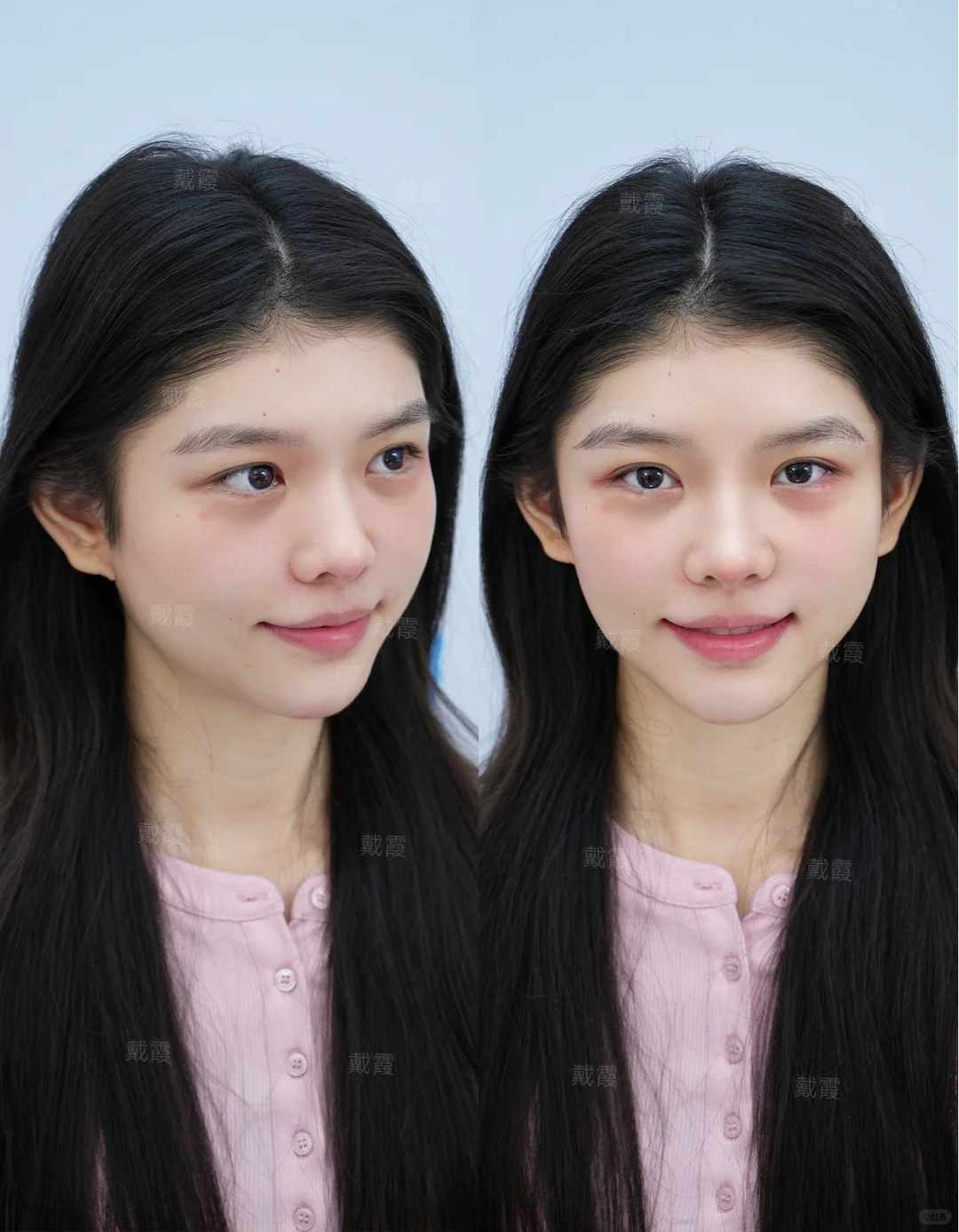 变美日记✅高阶幼态脸do脸模版来咯~