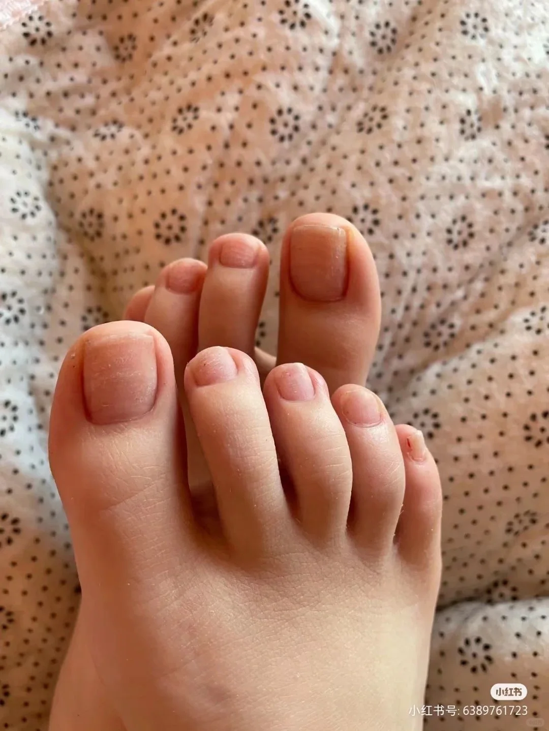 小脚丫