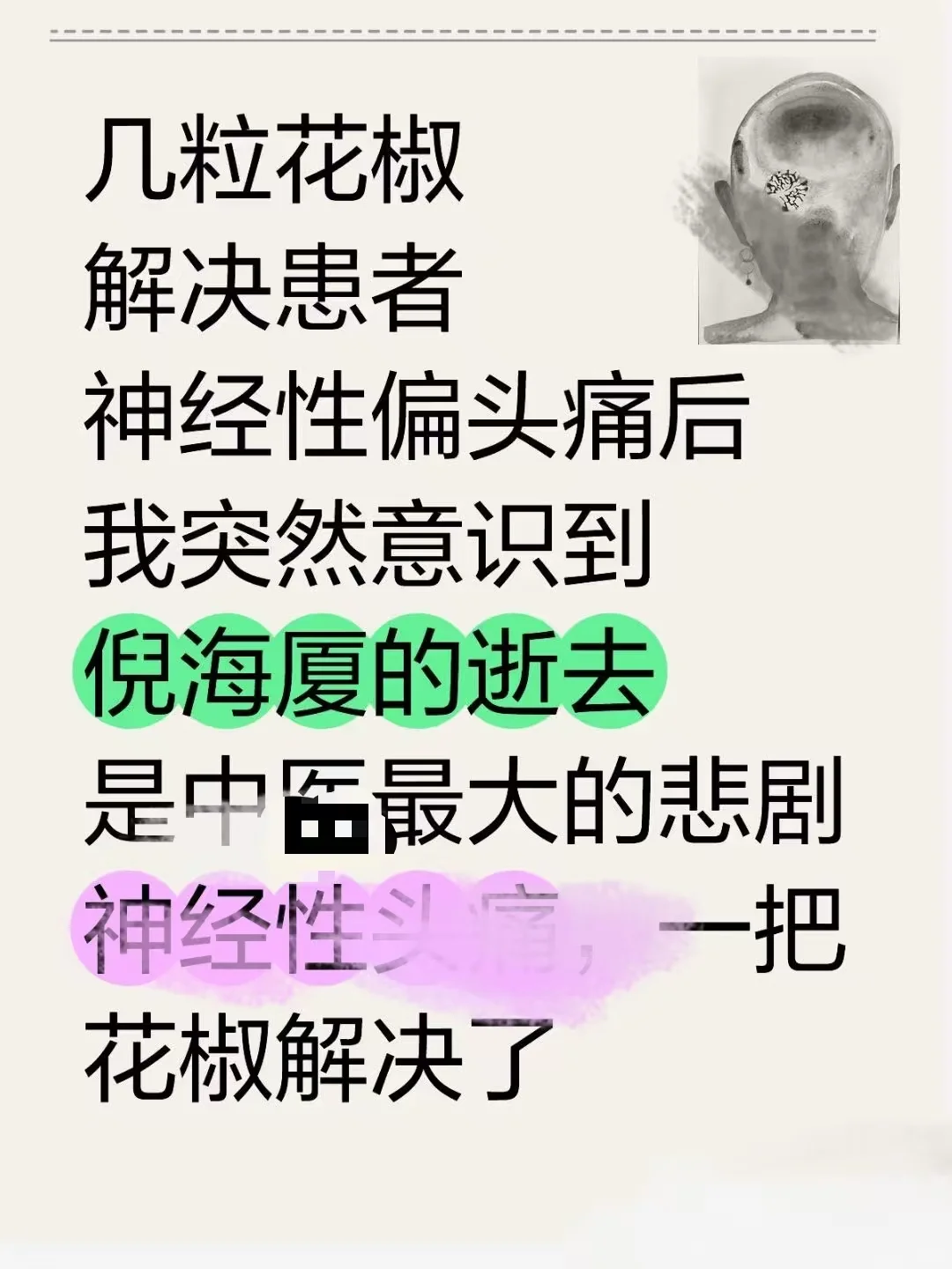 一把花椒，改善了我的偏头痛