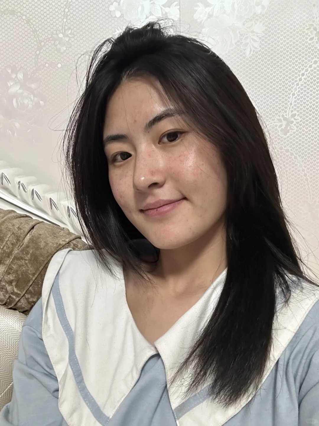 痘痘好了之后的皮肤状态，这样算什么水平