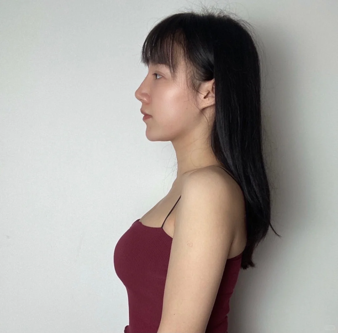 平胸a-c