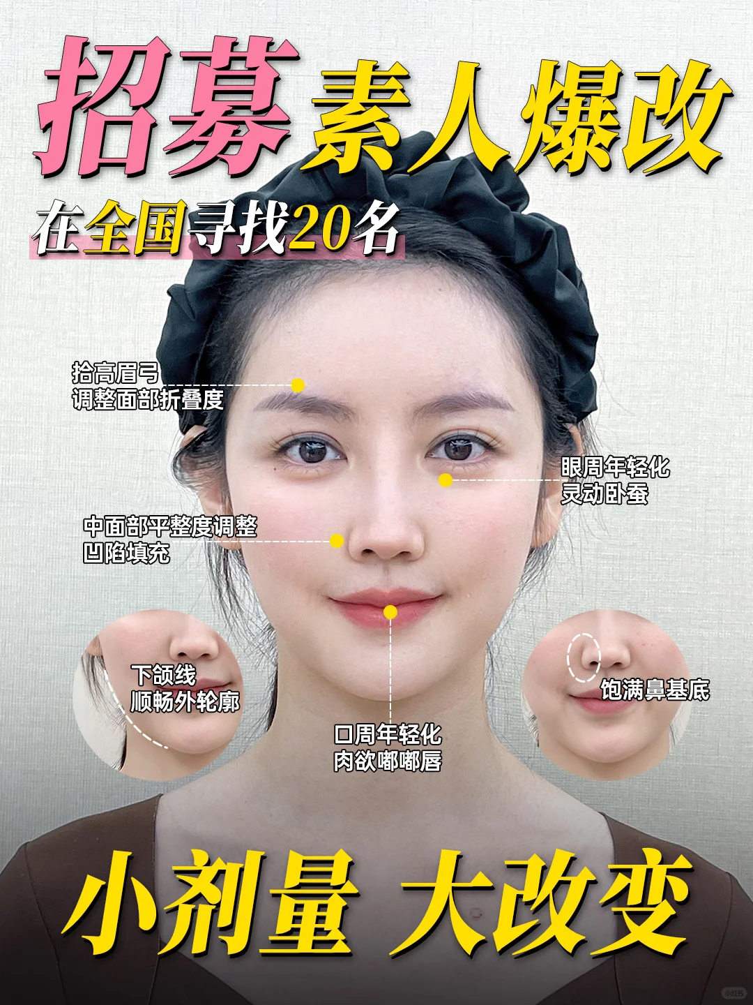 全网招募幼态脸案例模特❗想变美的宝子快❗