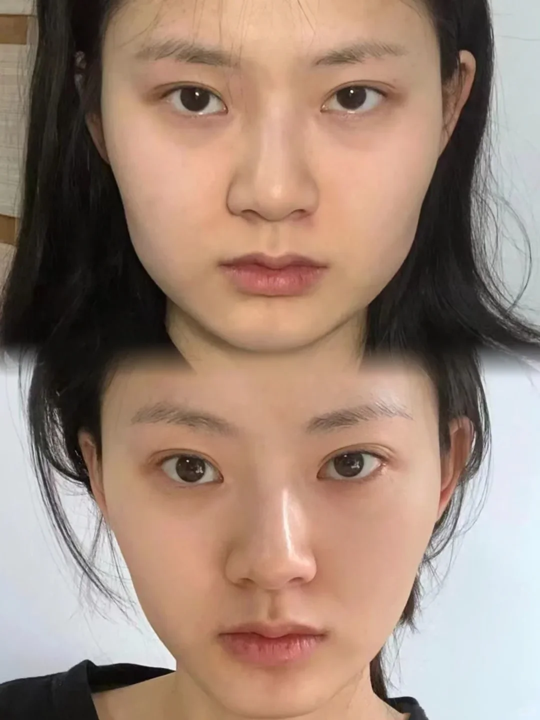 会说话的脸，从变美开始