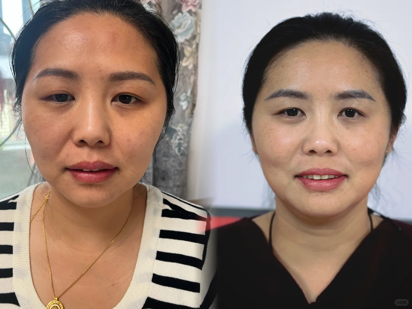 漂亮没有定义，但她比以前漂亮