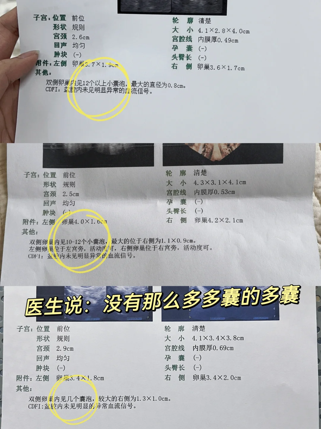 为啥给我开二甲双胍呢？我这个抵抗吗？