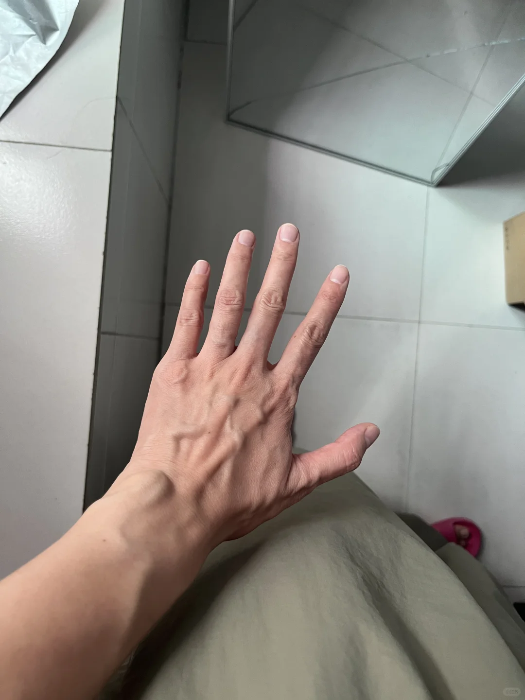 一个女生，因为这双手，自卑了30多年…