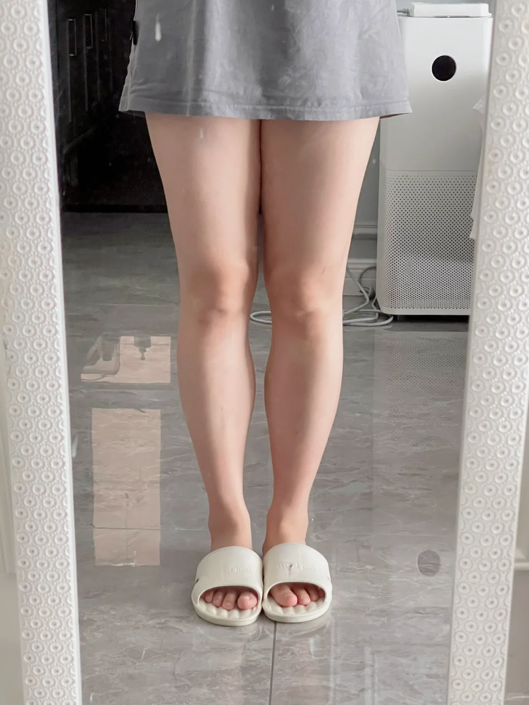 小粗腿怎么了