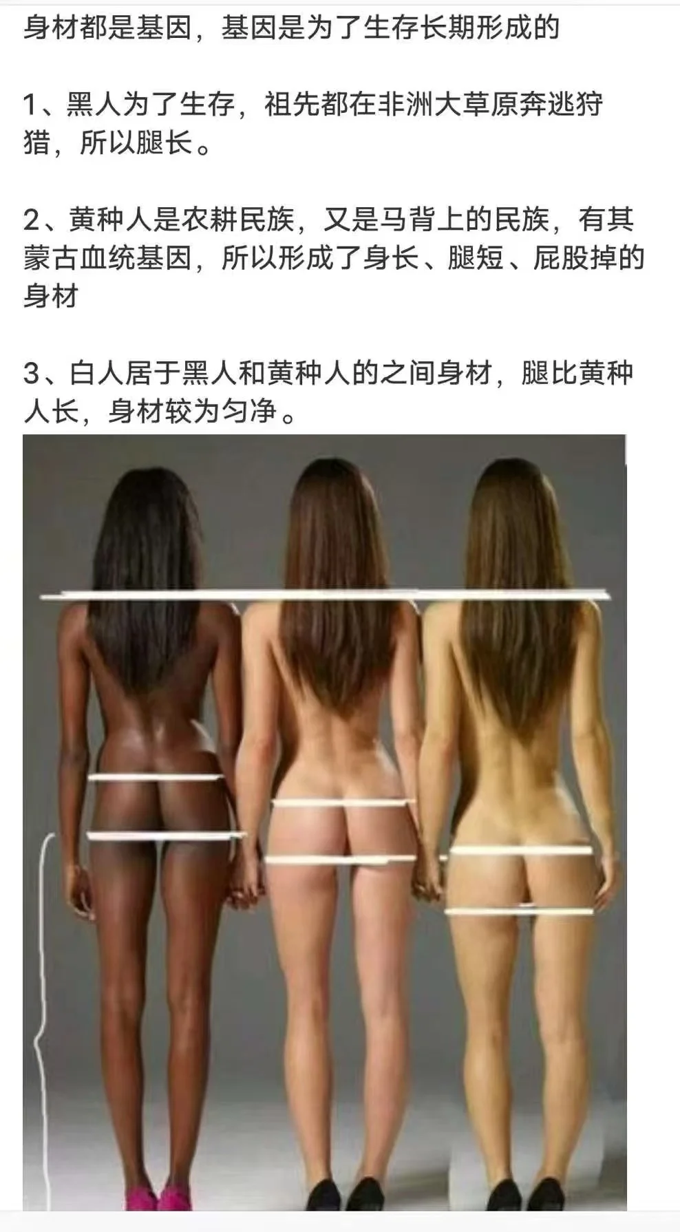 基因