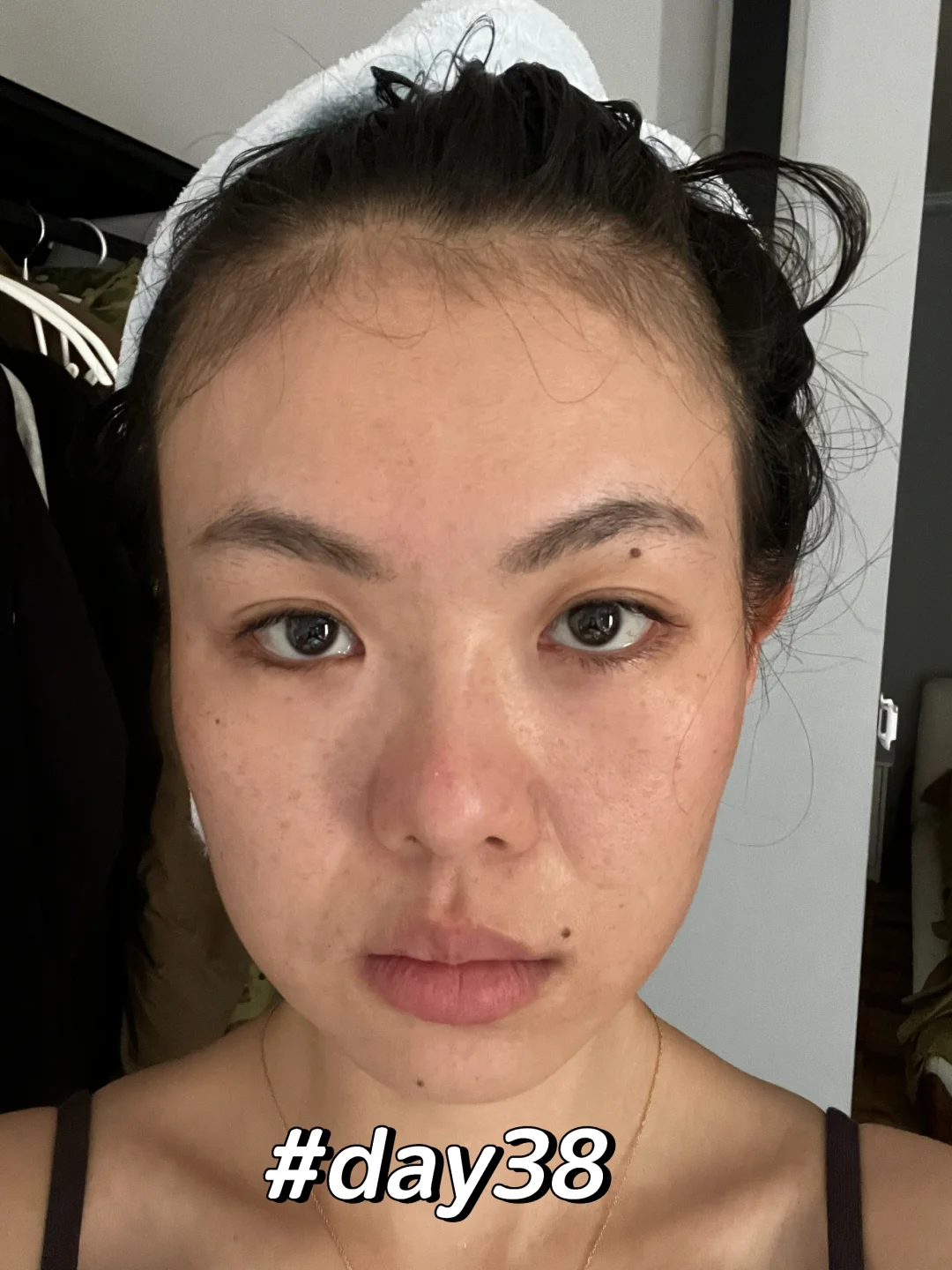 超声炮do脸不如早睡