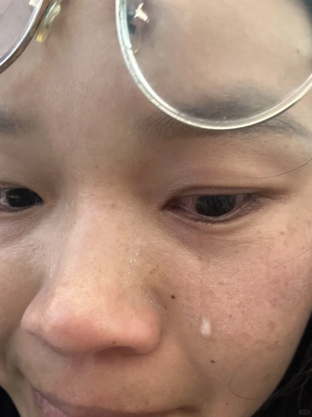 脸上的班把我急哭了