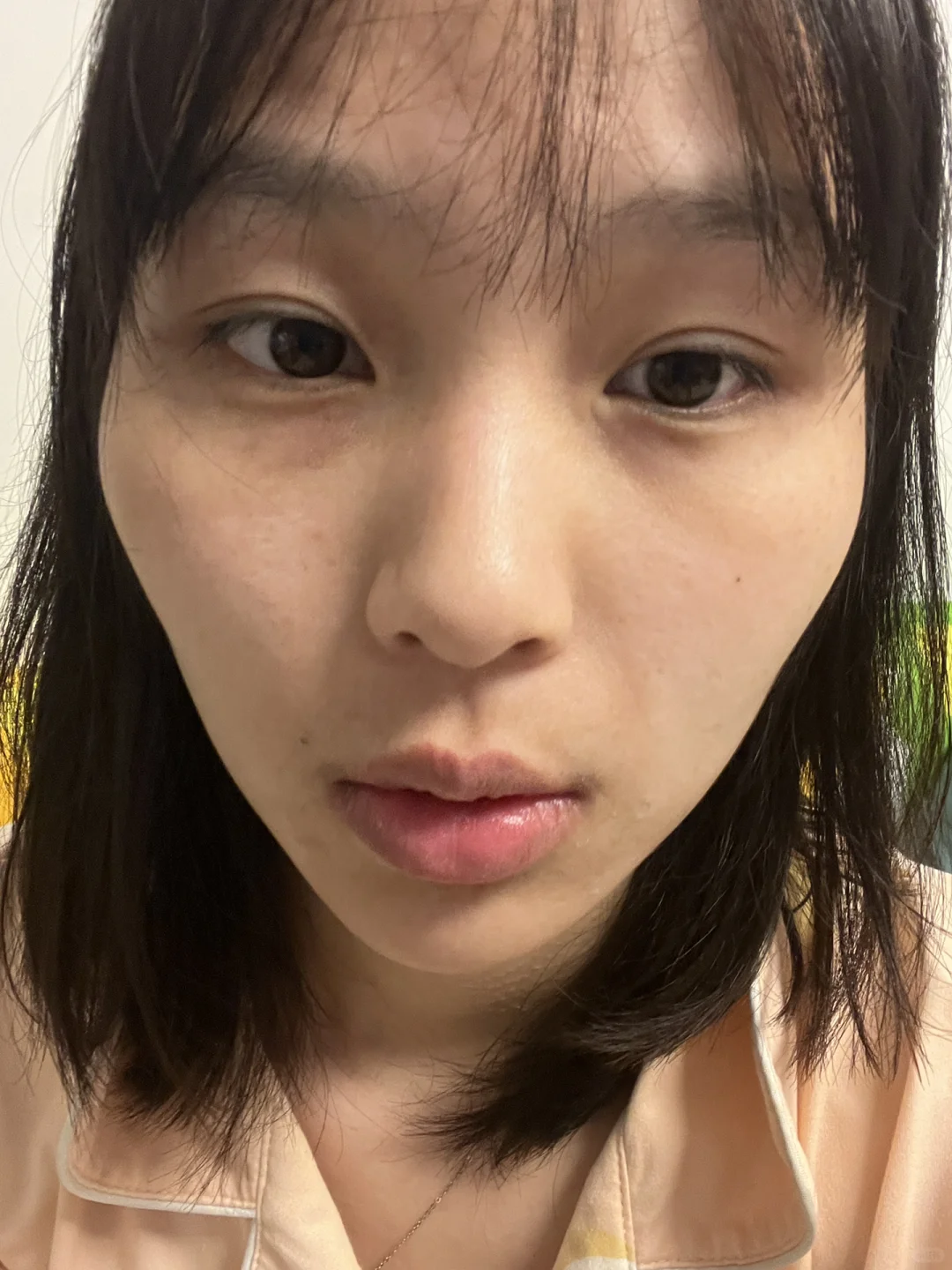 如何长肉只长脸上啊