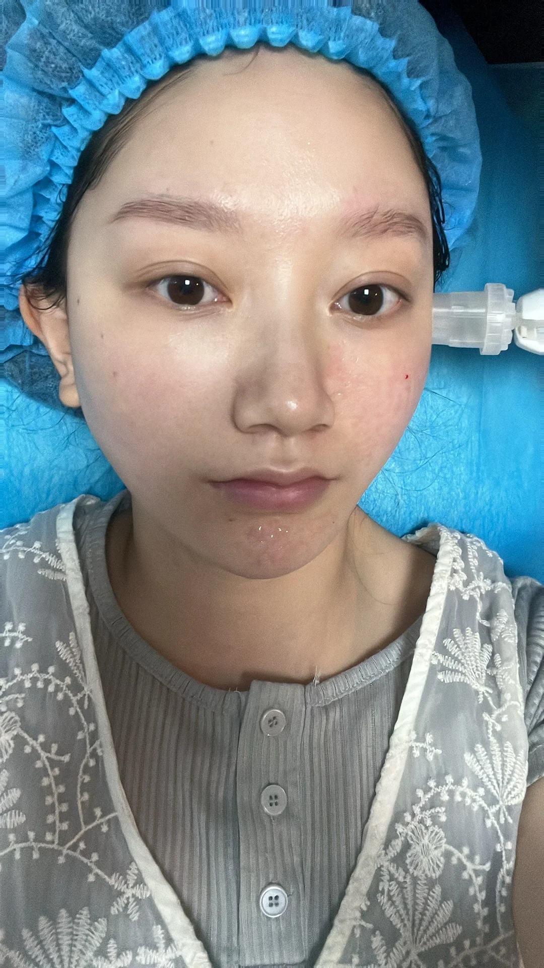 全年do脸总结|26岁女生2024都做了哪些