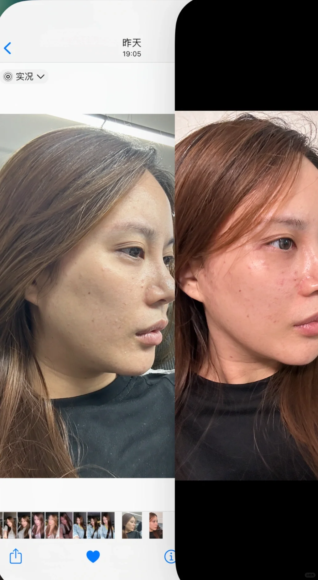 原相机｜全脸小剂量改造