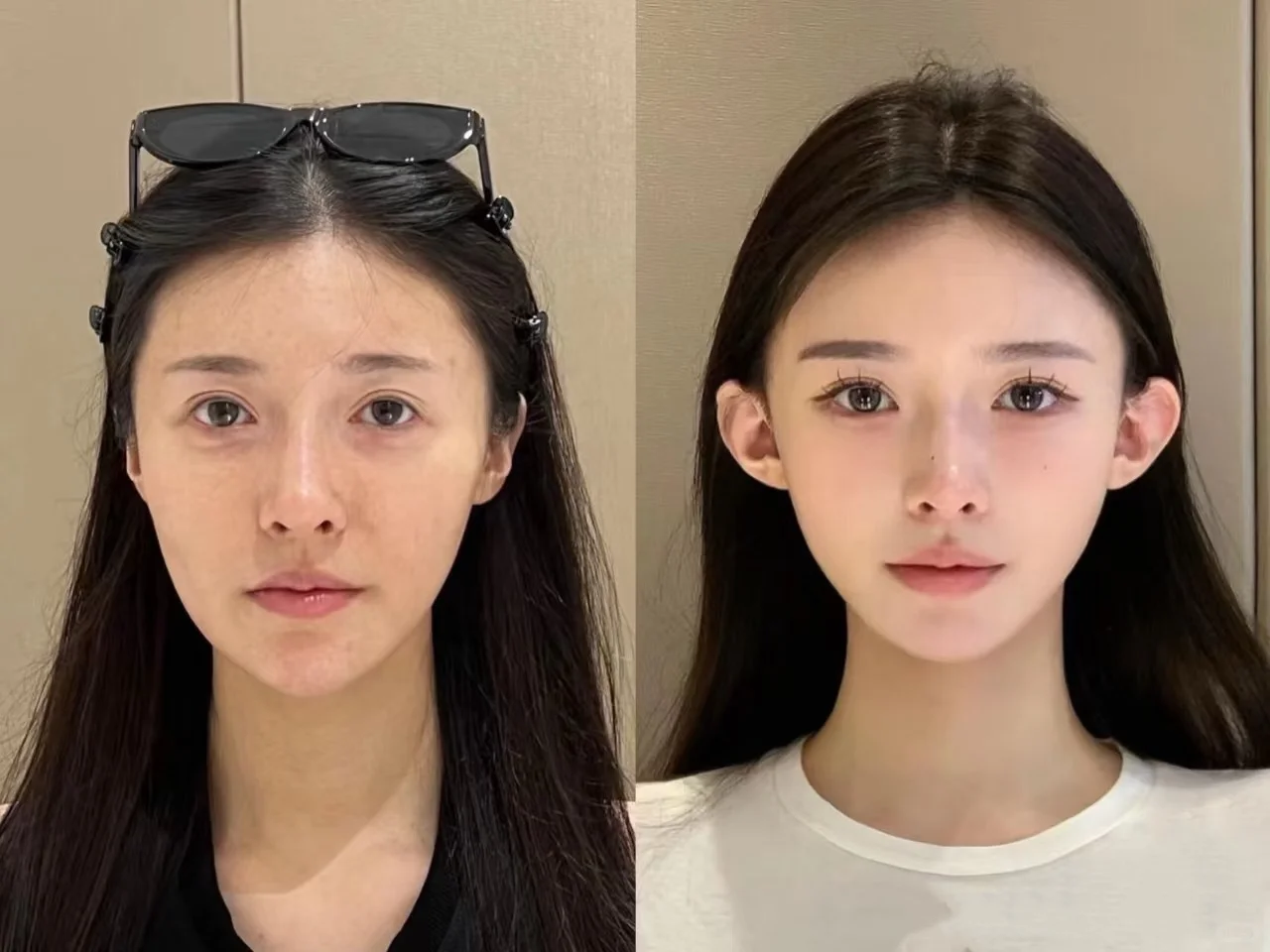 再也不弄幼、态脸了，好烧钱
