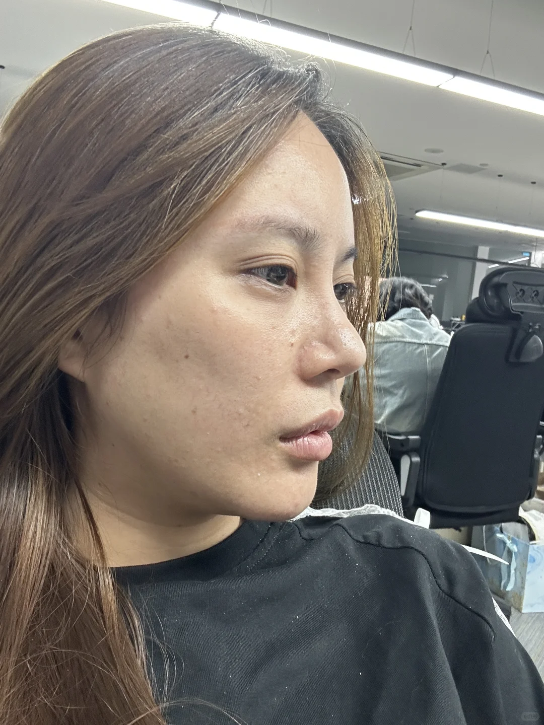 原相机｜全脸小剂量改造
