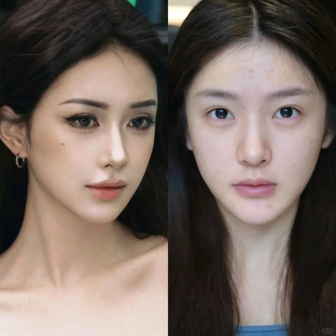 现在就没有天然美女么？这么自然也是科技脸