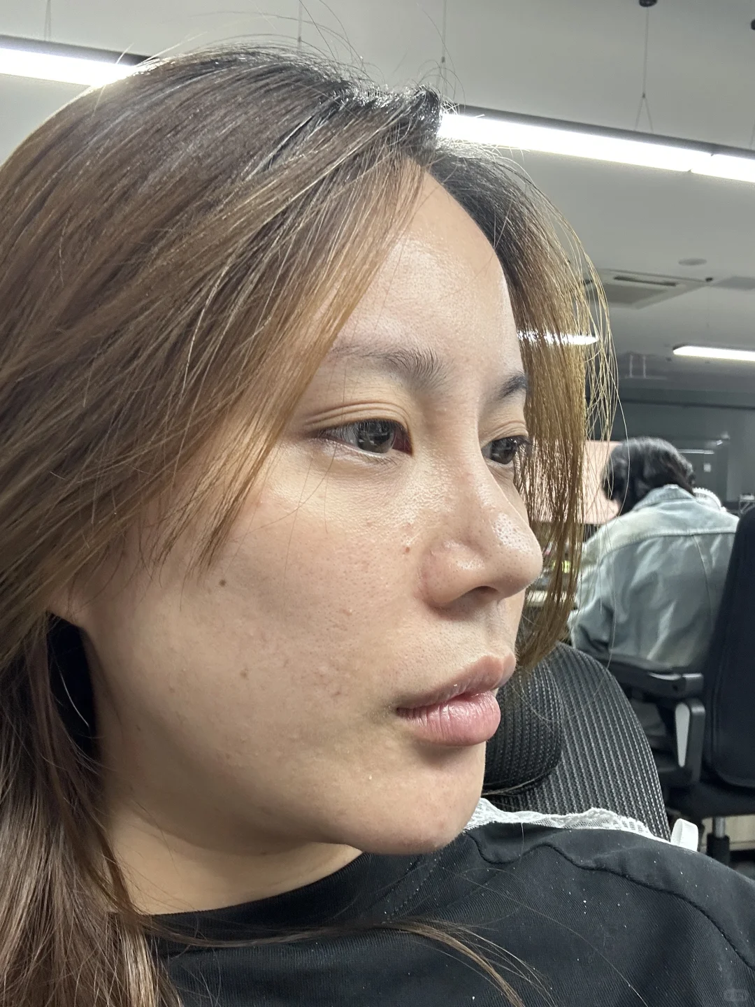 原相机｜全脸小剂量改造