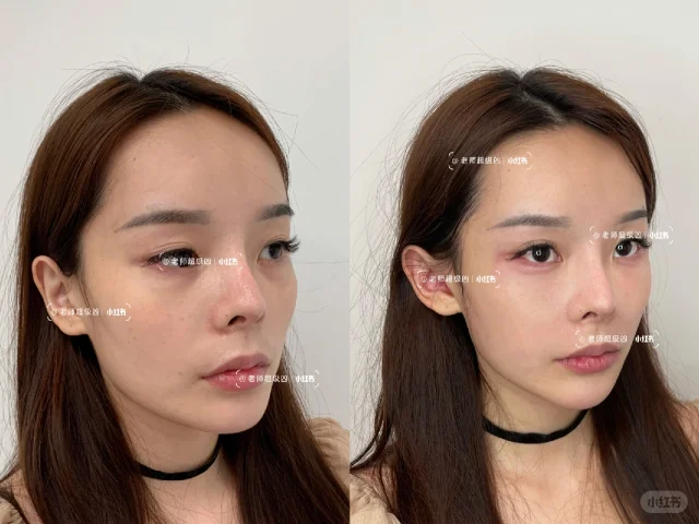 为什么现在整张脸看着柔和了？