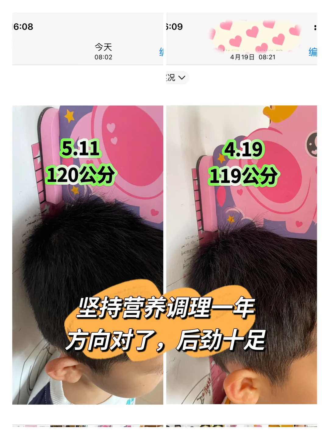 谁说鼻炎娃有腺样体肥大不好长身体？来看我