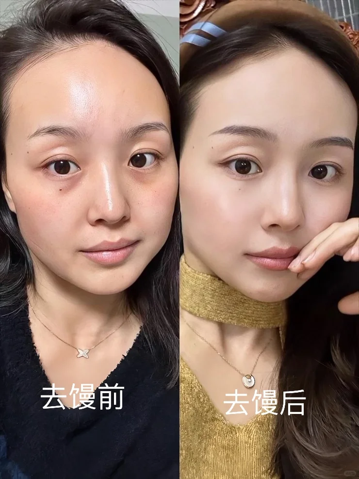 勇敢的人先享受美丽！ 砸3个值了吗