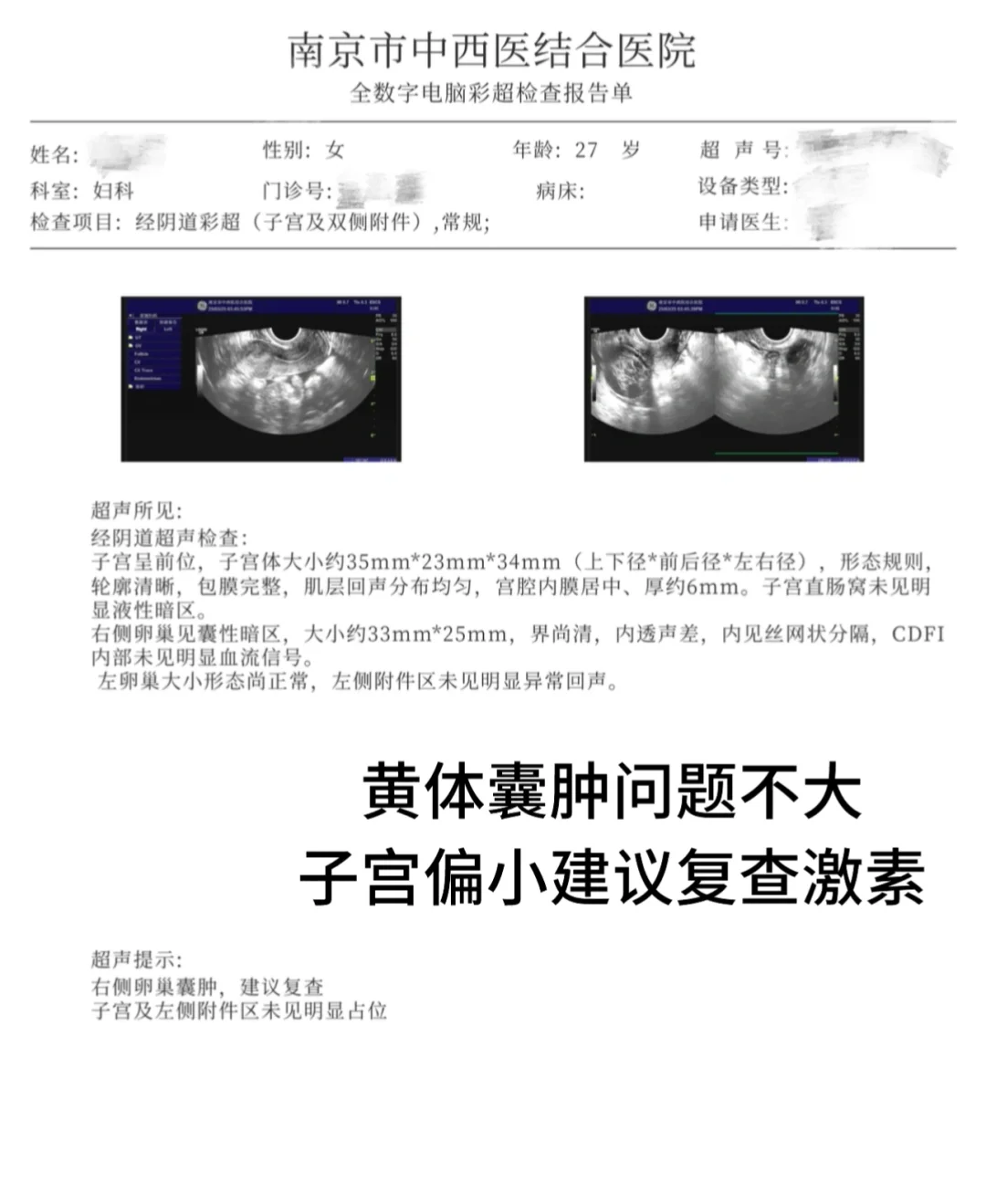 多囊→胰岛素抵抗 | 我的确诊经历分享