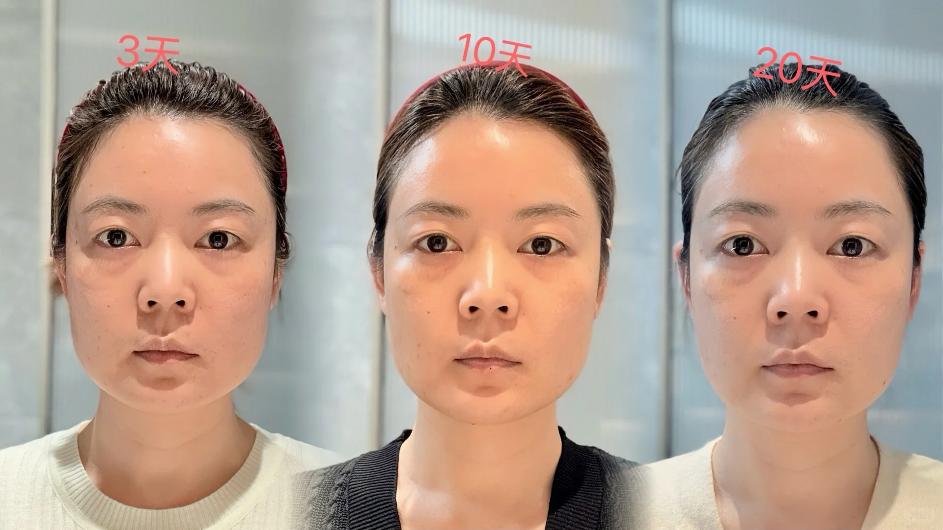 保妥适变化惊人