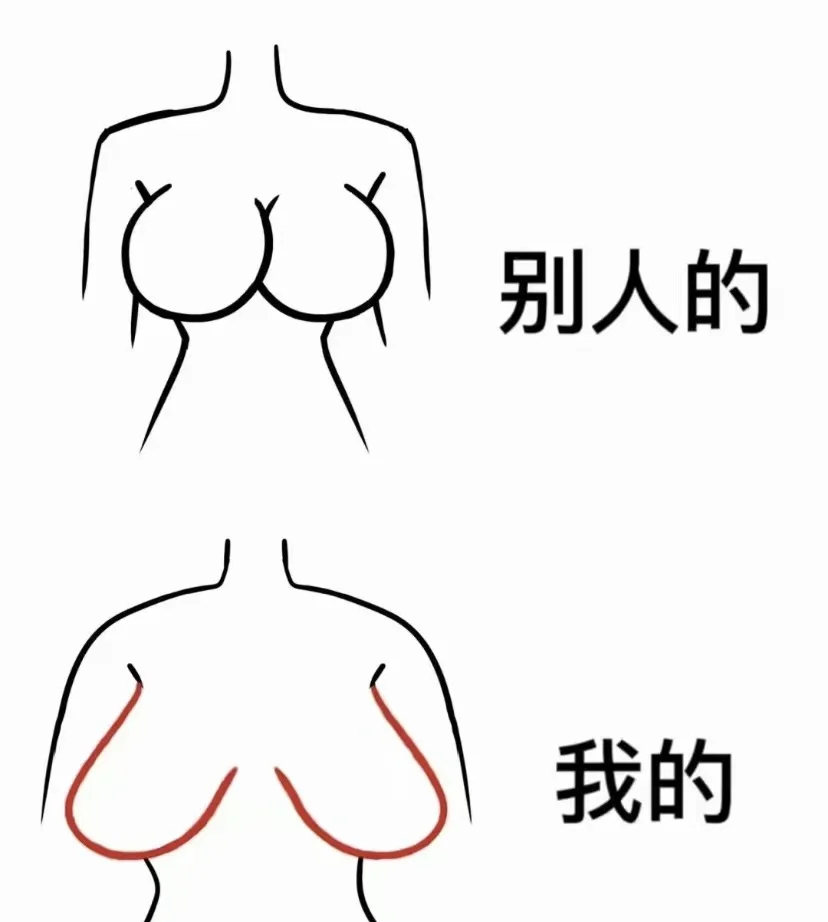 谁懂🐻下垂的痛
