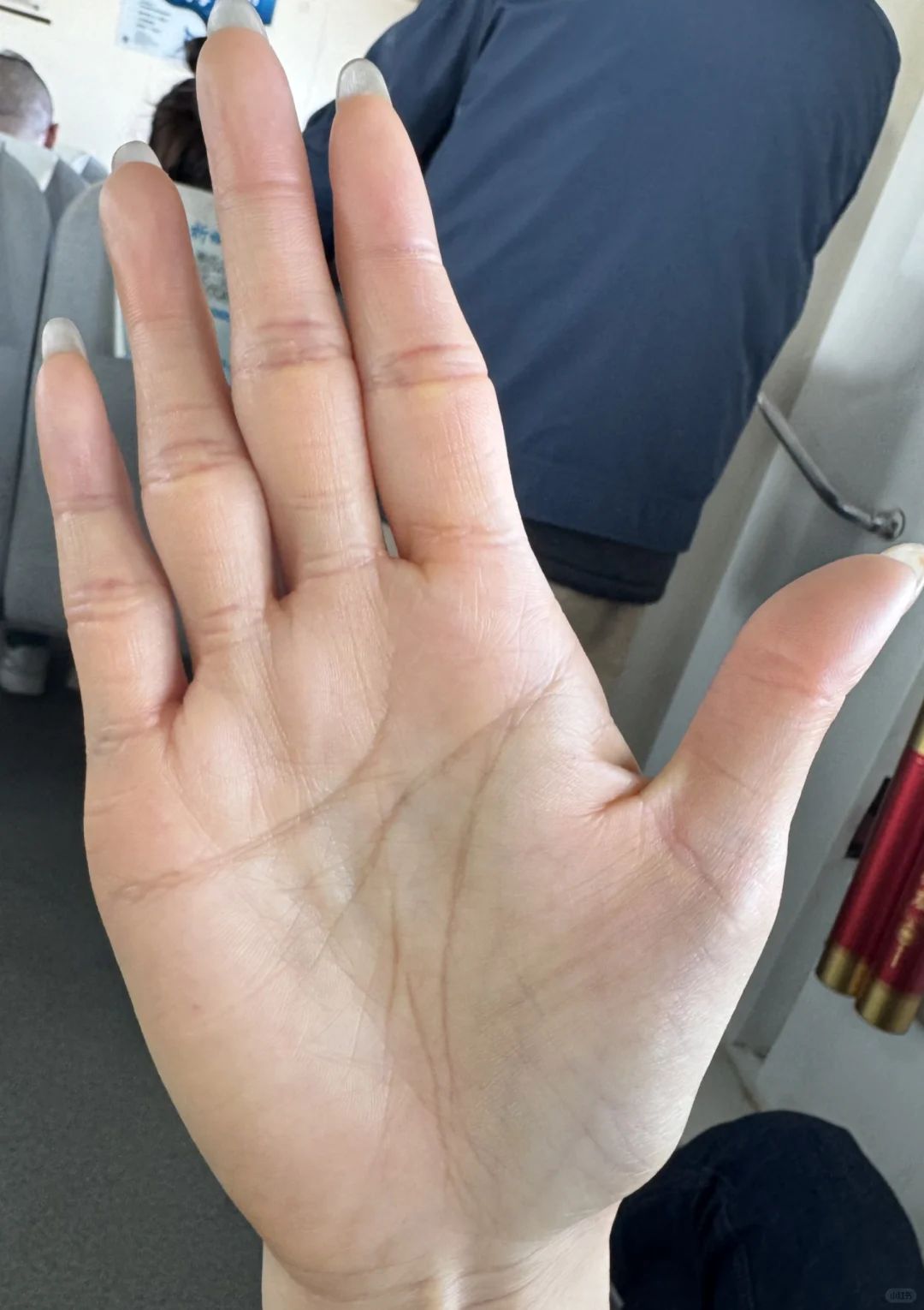 【你的手型暴露了健康密码？木型手必看