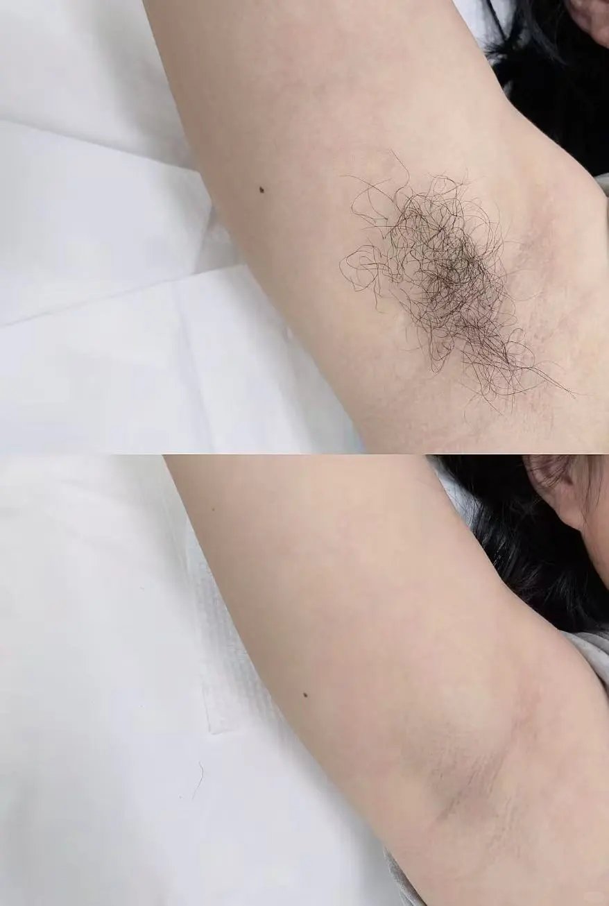 夏天就要做个干干净净的女孩子，拒绝尴尬