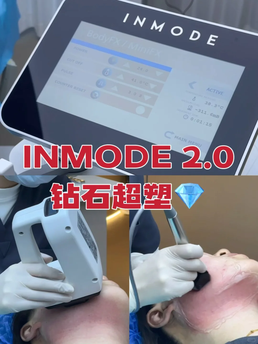 📝记录｜给脂肪一点点震撼❗️